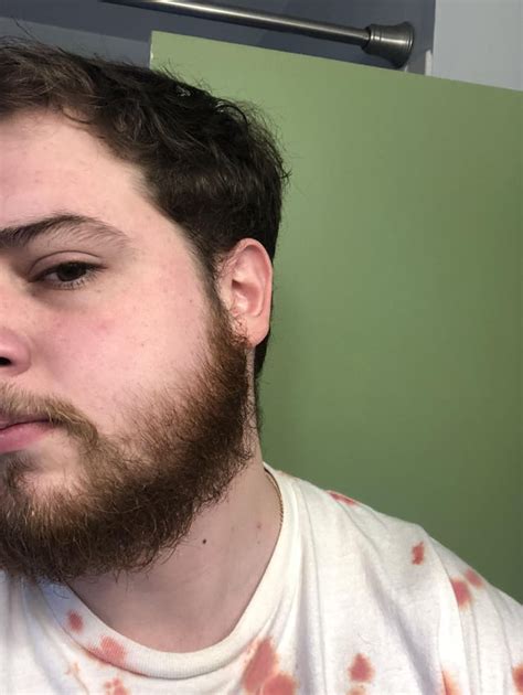 Hit Awkward Stage Need Advice 23 Year Old First Beard R Beards