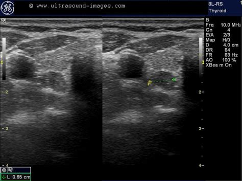 A Gallery of High-Resolution, Ultrasound, Color Doppler & 3D Images ...