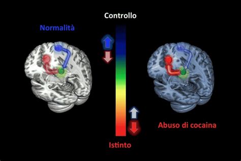 Uso Di Cocaina Produce Una Alterazione Cerebrale Forse Alla Base Del