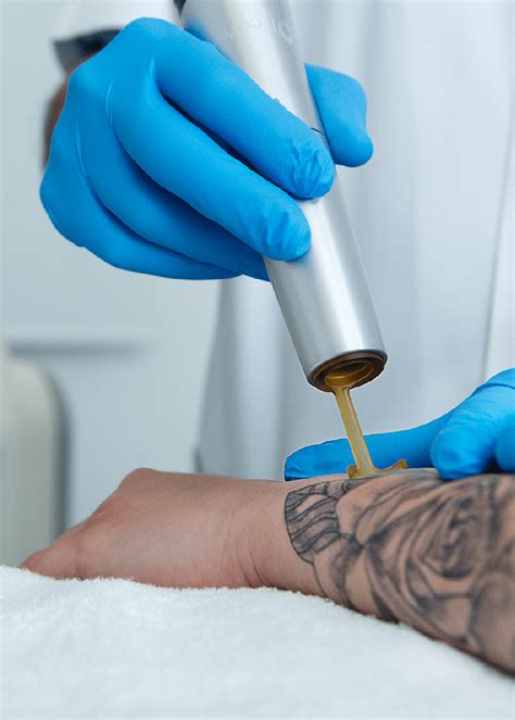 Eliminaci N De Tatuajes Con L Ser Picoway Clinica Tufet Barcelona