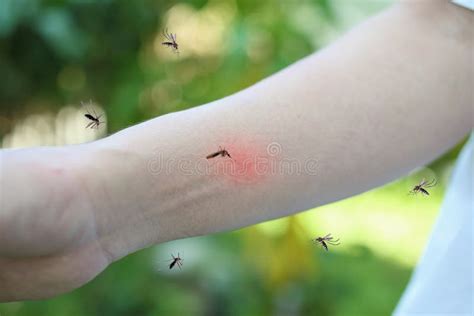 Mosquito Bite On Adult Arm With Skin Rash And Allergy With Red Spot