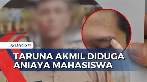 Mahasiswa Kedokteran Di Medan Ngaku Dianiaya Taruna Akmil Korban