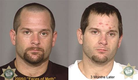 Meth Addicts: Before and After (38 pics) - Izismile.com