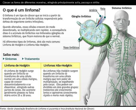 Rio Enfermagem Linfoma de Hodgkin x Linfoma Não Hodgkin