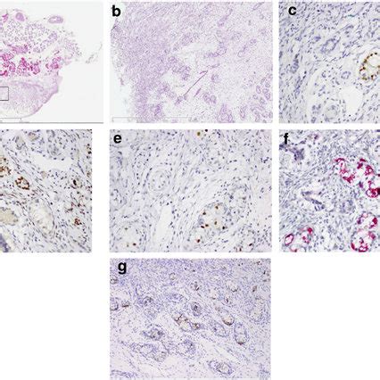 Representative Histological And Immunohistochemical Findings For The