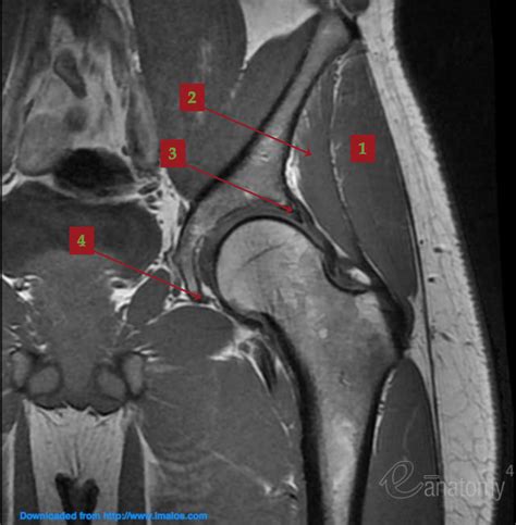 Normal Hip MRI Coronal View Class Diagram Quizlet