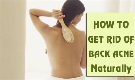 How To Get Rid Of Back Acne Fast 10 Best Bacne Treatments Back Acne