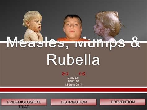 Measles, mumps & rubella