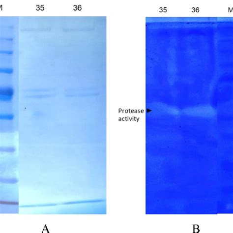 Results Of Sds Page A And Casein Zymogram B Of Protein From Blood Of T