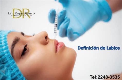 Definición de labios Dr Eric Rojas Dermatología Laser Center