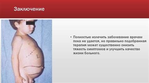 Болезнь Ниманна-Пика - презентация онлайн