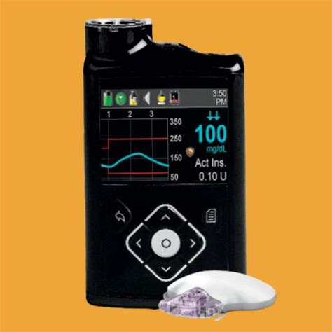 10 Best Insulin Pump in 2024 | Lowest Price