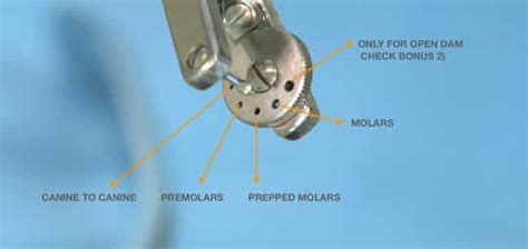 Rubber Dam Isolation Technique Dental Guide For Clamp Selection