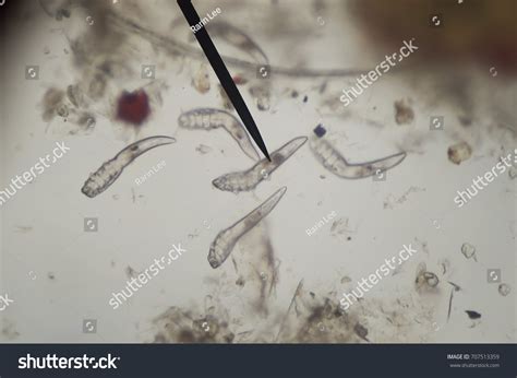 Microscopic Parasites On Human Skin