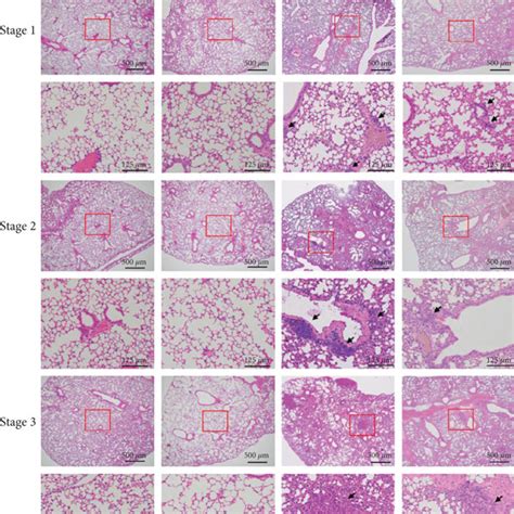 Progression of lung cancer was significantly inhibited in Abt-Kras ...