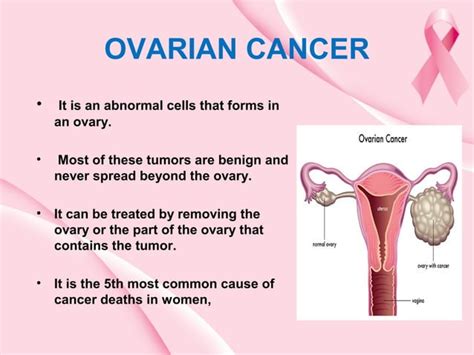 Reproductive Tract Malignancy Ppt