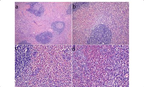 Hematoxylin And Eosin Stained Sections Of The Right Inguinal Lymph Node