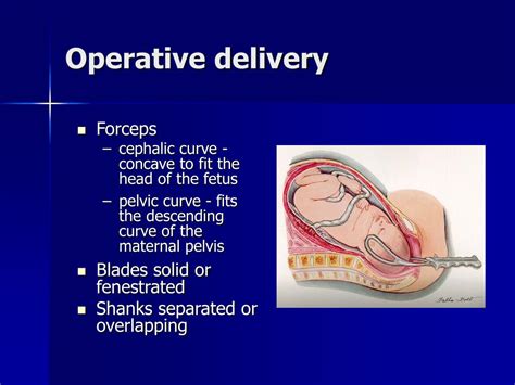 Ppt Intrapartum Management Powerpoint Presentation Id