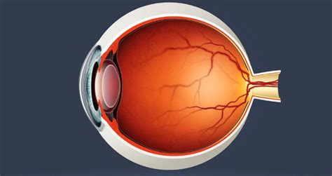 Stages Of Diabetic Retinopathy Karen Alsop