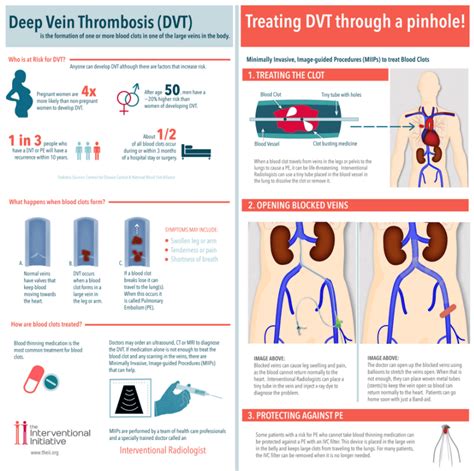 Deep Vein Thrombosis Treatment