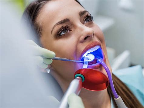 Clareamento Dental A Laser Conhe A As Vantagens E Benef Cios