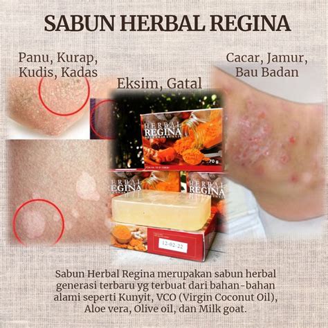 Jual SABUN HERBAL REGINA SABUN PENGHILANG PANU KURAP EKSIM CACAR