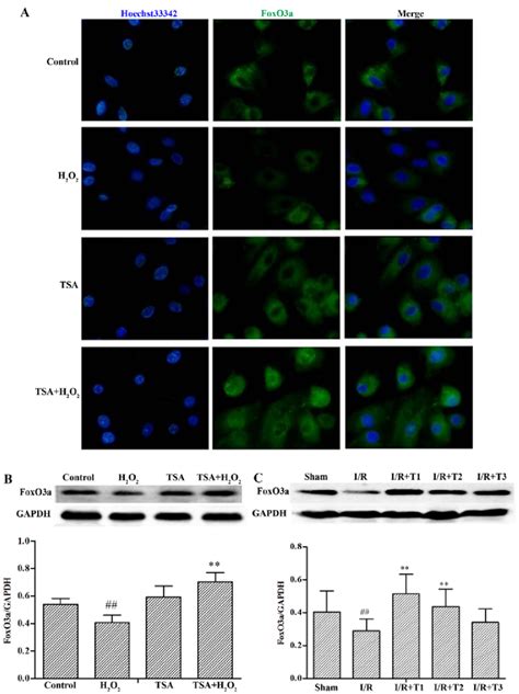 Effect Of Trichostatin A Tsa On The Expression Of Forkhead Box O A