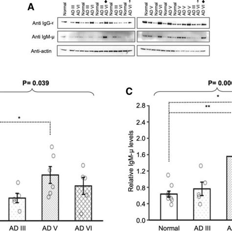 Western Blot Analyses Of Human Igg Gamma Chain And Human Igm Mu Chain