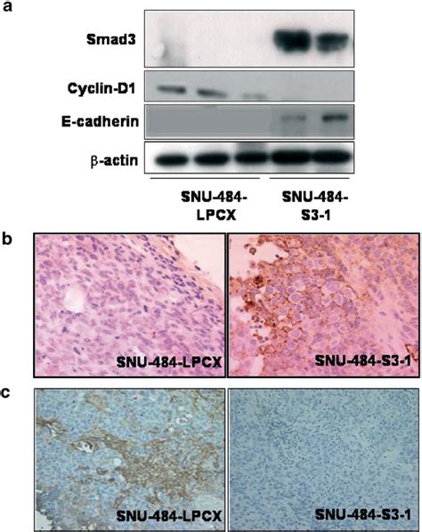 Immunoblot Analysis Of Cyclin D1 And E Cadherin And Download