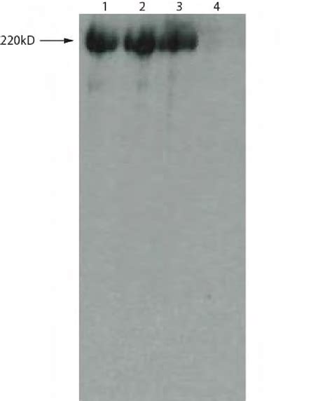 6 Representative Immunoblot Of Myosin Run On 24 Hour Gel 1 Wt 2