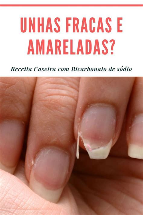 Acabe Com Unhas Fracas E Quebradiças Com Essa Receita Caseira Com