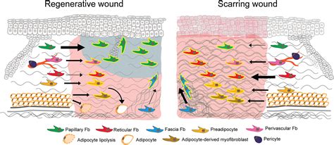 Skin Fibroblast Functional Heterogeneity In Health And Disease Bensa