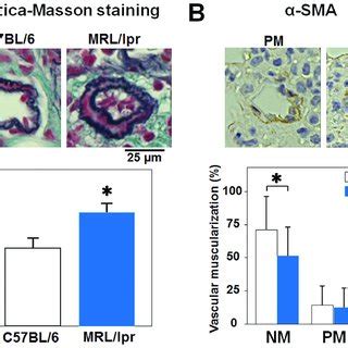 Amelioration Of Lupus Nephritis In Mrl Lpr Mice Treated With Kn As