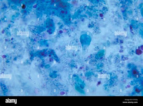 Giardia Lamblia Trophozoite Trichrome Stain Parasite Image Courtesy Cdcdr Mae Melvin 1962