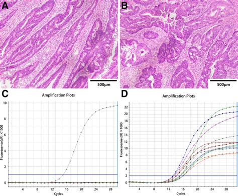 Representative Histological Images With Kras Wild Type Crc Patient Top