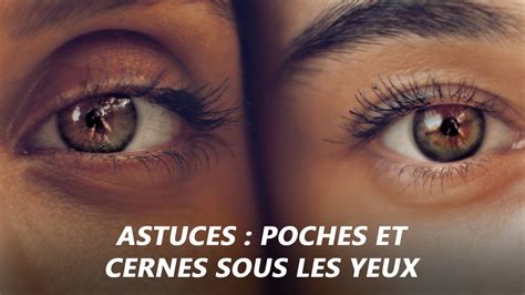 Astuces Pour Se D Barrasser Des Cernes Et Des Poches Sous Les Yeux