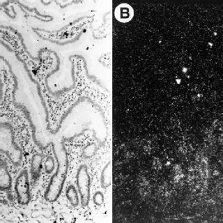 Bright Field A And Dark Field B Photomicrographs Of The Mucosa Of