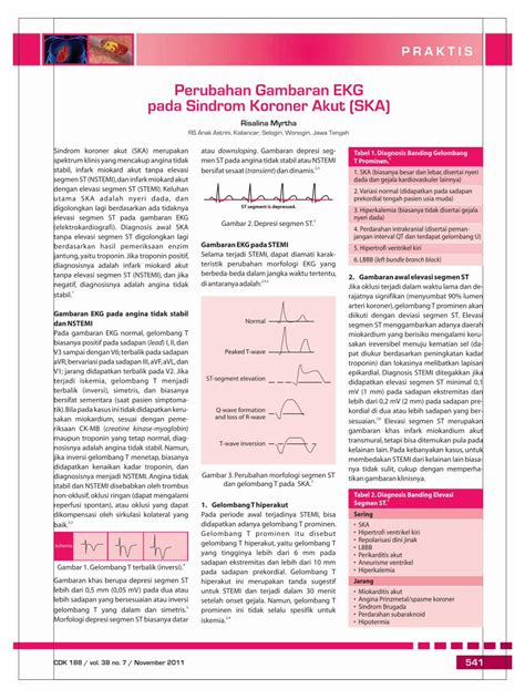 Pdf 31 188praktis Perubahan Gambaran Ekg Pada Sindrom Koroner Akut