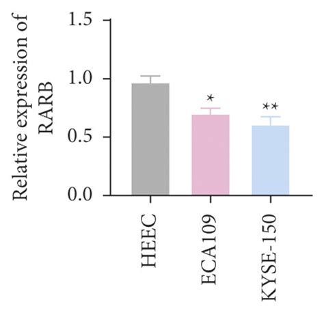 Expression Of Seven Model Genes In ESCA Cell Lines And Human Normal