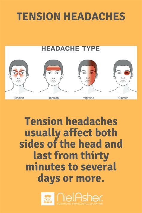 Tension Headaches And Trigger Points Dr Jonathan Kuttner Md Tension