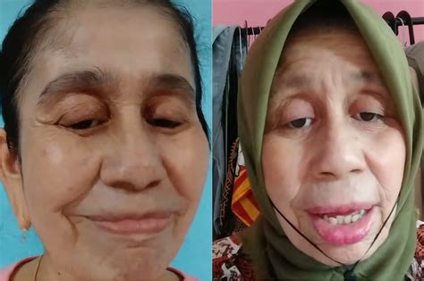 Viral Wajah Wanita Asal Bogor Sudah Seperti Nenek Nenek Padahal Umurnya Baru 28 Tahun Ini