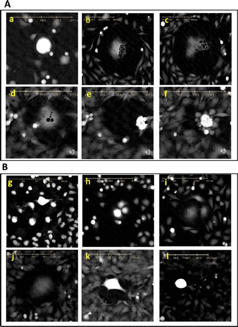 Tracking Of Giant Hela Cells A Tracking Of A Giant Hela Cell With