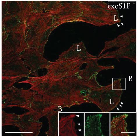 Cytoskeleton Organization And Cortactin Expression Bm Mscs Were Download Scientific Diagram