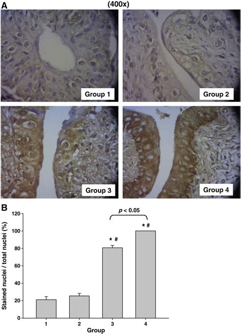 Effects Of Bbn And Or Arsenic On The Dna Oxo Dg Levels In The Mouse