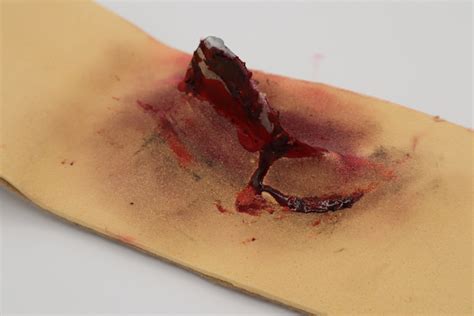 Penetrating Wound