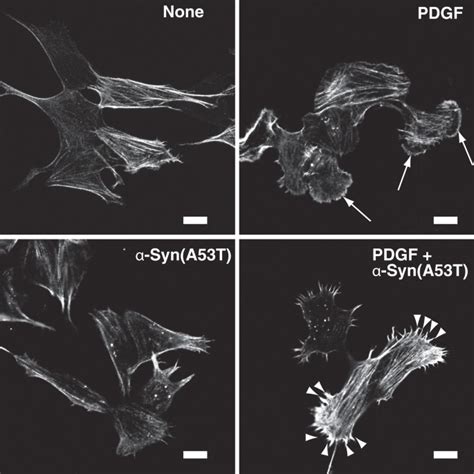 Impairment Of Pdgf Induced Chemotaxis By Extracellular α Synuclein