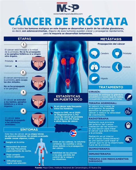 Cancer De Prostata Causas