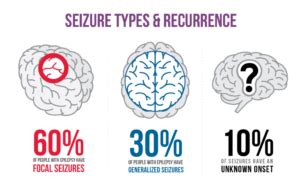 Epilepsy: Causes, Symptoms and Treatment - Public Health Notes