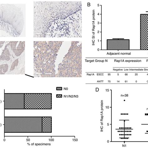 The Expression Of Rap1a Is Upregulated In Escc A Ihc Staining