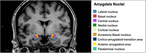 Hippocampus Amygdala Mri